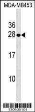 Anti-SPINT2 (C-term) Antibody