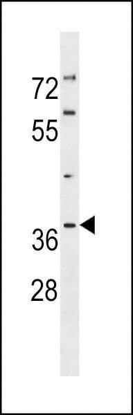 Anti-PIG3 (C-term) Antibody