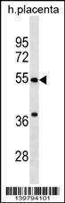 Anti-CHST2 (C-term) Antibody