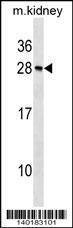 Anti-Mouse Rcvrn (N-term) Antibody