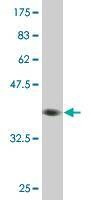 Anti-FAAH Antibody