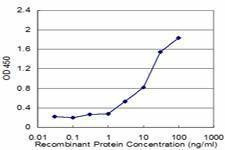 Anti-FAAH Antibody