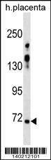 Anti-ZNF251 (N-term) Antibody