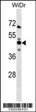 Anti-NMI (N-term) Antibody