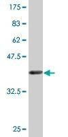 Anti-FANCB Antibody
