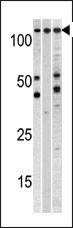 Anti-Cellular Apoptosis Susceptibility (C-term) Antibody