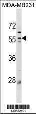 Anti-Plin3 (C-term) Antibody