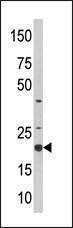 Anti-SKP1 (Center) Antibody