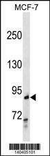 Anti-RALBP1 (N-term) Antibody