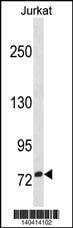 Anti-ZNF274 (N-term) Antibody