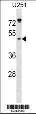 Anti-ILKAP (Center) Antibody