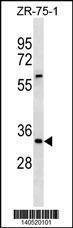 Anti-ING2 (Center) Antibody