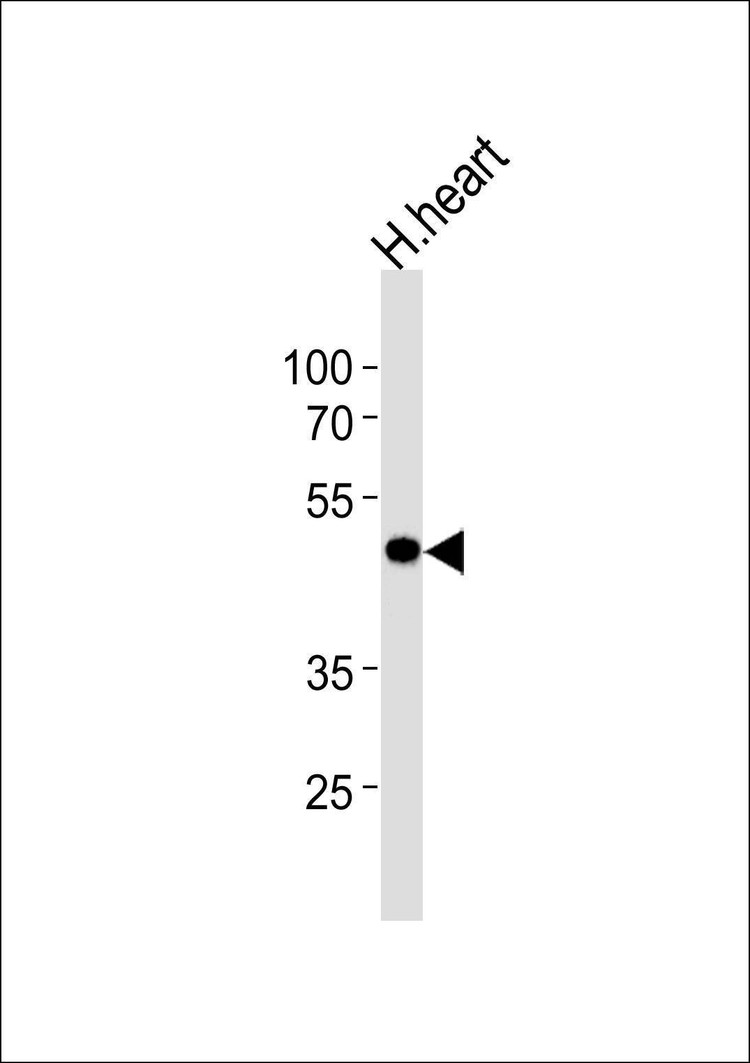 Anti-KCNAB1 (N-term) Antibody