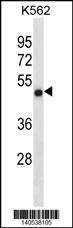 Anti-CCDC6 (N-term) Antibody