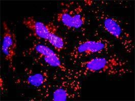 Anti-FAS Antibody