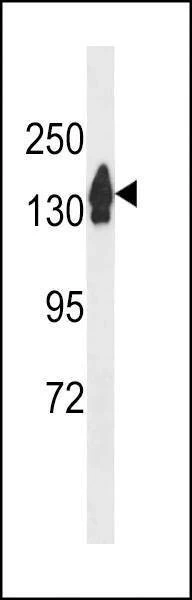 Anti-RECQL4 (C-term) Antibody