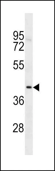 Anti-TOX2 (Center) Antibody