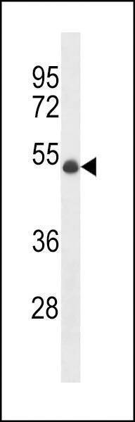 Anti-UBR7 (N-term) Antibody