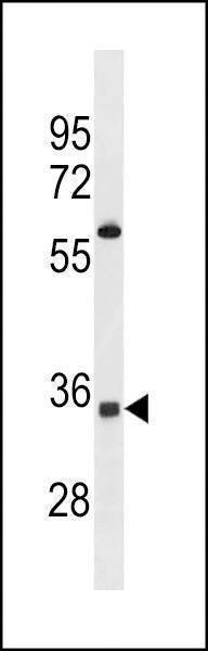 Anti-OR52A5 (C-term) Antibody