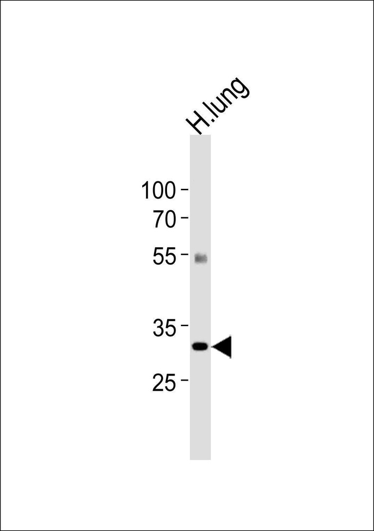 Anti-CSF2RA (C-term) Antibody
