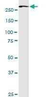 Anti-FASN Antibody