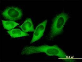 Anti-FASN Antibody