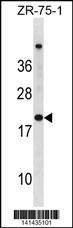 Anti-CDKN2A (N-term S8) Antibody
