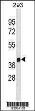 Anti-FANCL (C-term) Antibody