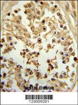 Anti-EIF4E Antibody