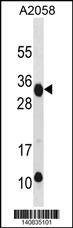 Anti-RAET1E (Center) Antibody