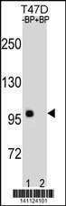 Anti-CTNNB1 (C-term) Antibody
