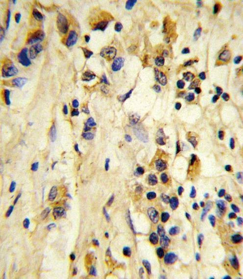 Anti-EIF4E2 Antibody