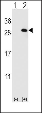 Anti-EIF4E2 Antibody