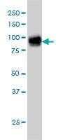 Anti-FBLN1 Antibody