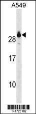 Anti-GSTT2 (Center) Antibody