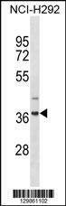 Anti-ZNF696 (N-term) Antibody