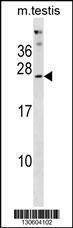Anti-PHOSPHO2 (N-term) Antibody