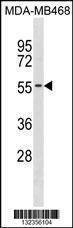 Anti-KCNK6 (C-term) Antibody