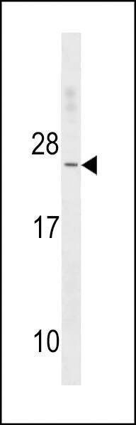 Anti-TNNC2 (C-term) Antibody