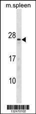Anti-TNNC2 (C-term) Antibody