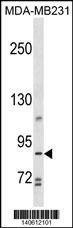 Anti-TROAP (N-term) Antibody