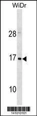 Anti-HBZ (C-term) Antibody
