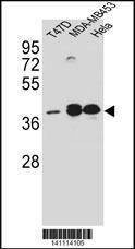 Anti-ESR2 (Center) Antibody