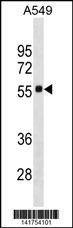 Anti-SCARB1 (N-term) Antibody
