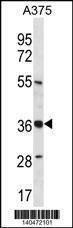 Anti-PIH1D1 (Center) Antibody