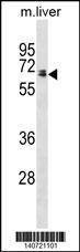 Anti-Rat Ggt1 (N-term) Antibody