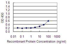 Anti-FBXL7 Antibody