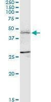 Anti-FBXL7 Antibody