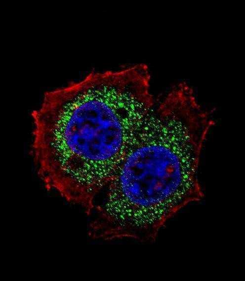 Anti-ESR1 isoform4 (Center) Antibody