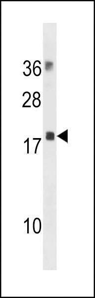 Anti-MYL12B (N-term) Antibody